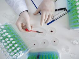top-view-researcher-s-hands-laboratory-drips-blood-sample-into-petri-dish-focus-dropper-flu-research-vaccine-creation_177786-320