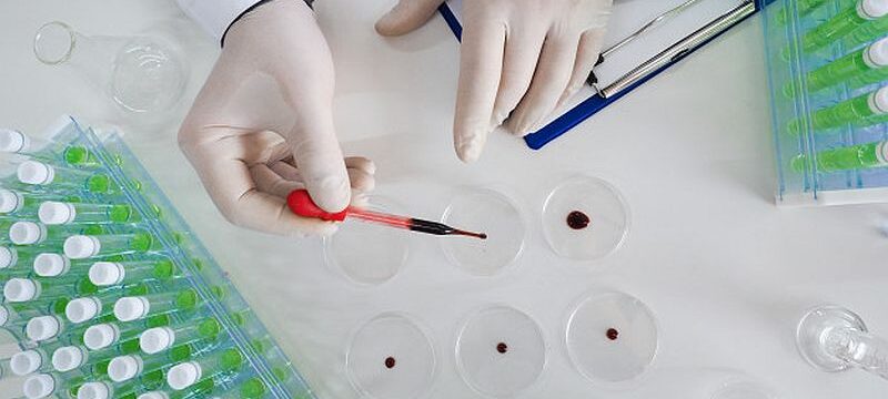 top-view-researcher-s-hands-laboratory-drips-blood-sample-into-petri-dish-focus-dropper-flu-research-vaccine-creation_177786-320