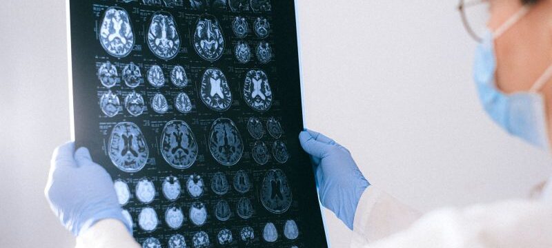 pexels-anna-shvets-4226219