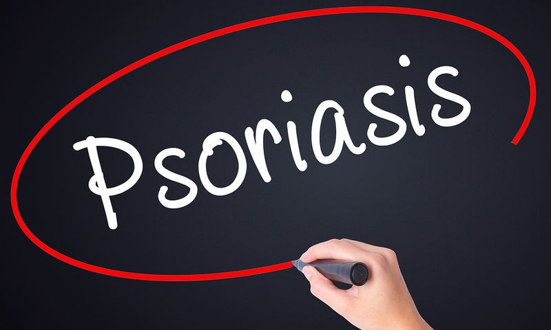 Ψωριάση και Covid-19: Live Διαδικτυακό Σεμινάριο