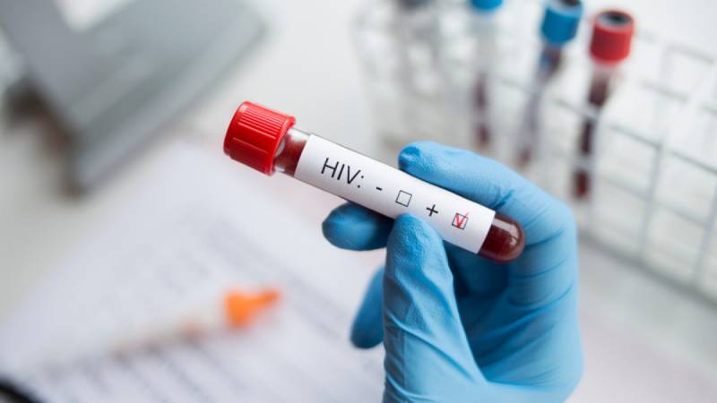 HIV: Βρέθηκε δεύτερος ασθενής που φαίνεται να απαλλάχτηκε τελείως από τον ιό με φυσικό τρόπο