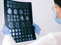 pexels-anna-shvets-4226219