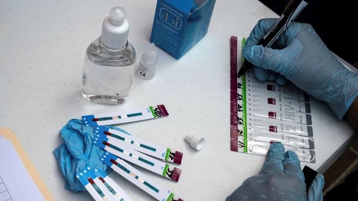 Οξφόρδη: Πιο μεταδοτικός ο ιός του AIDS εξαιτίας νέας παραλλαγής