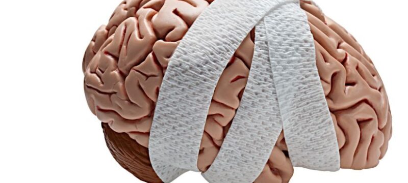 Human-Brain_Brain-Injuries_Head-Injuries_Head-Trauma_Brain-and-Head-Injury-Information_2