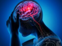 Man with brain stroke symptoms