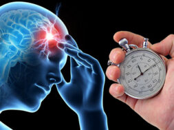 stroke_scale_nih