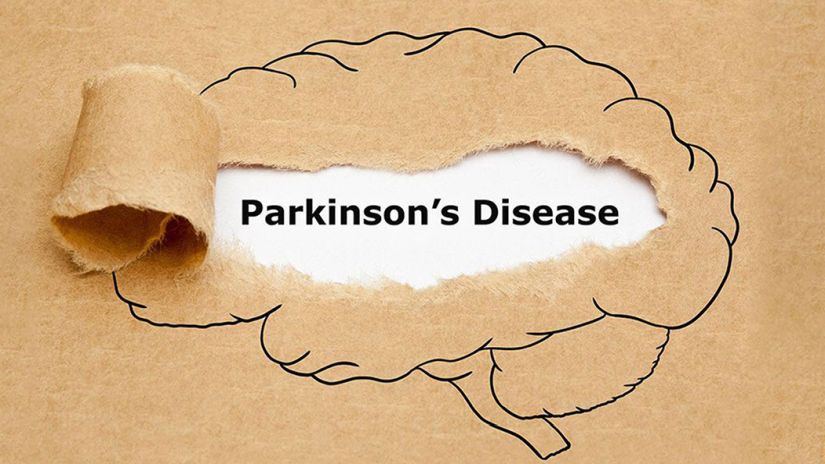 Νόσος Πάρκινσον : Η νόσος που μέχρι το 2050 θα έχει λάβει διαστάσεις πανδημίας