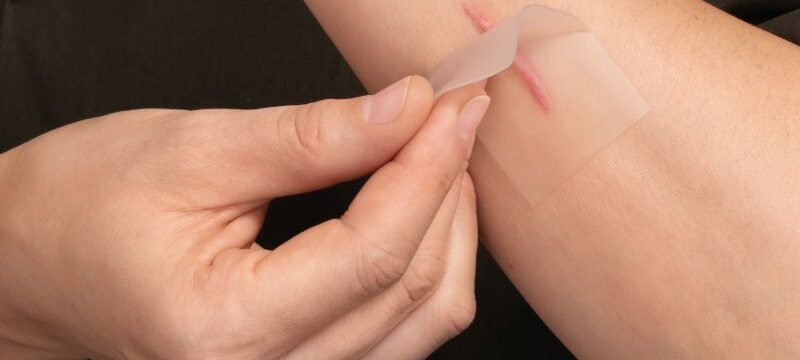 HANSAPLAST_Ανάπλαση Ουλών_Press Release 01 (002)