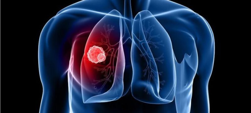 _96876834_gettyimages-100974359