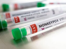 2022-05-22T133954Z_364798899_RC2BCU91EQHZ_RTRMADP_5_HEALTH-MONKEYPOX