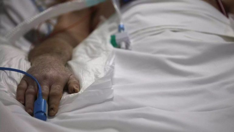 Δεν υπάρχει κανένας κίνδυνος για τα κρούσματα λέπρας στην Ελλάδα