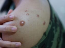 dreamstime_xxl_157655308-scaled