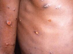 eulogia-pithikwn-960×600