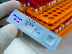 Marburg,Virus,Igg,Positive,Result,By,Using,Rapid,Test,Cassette