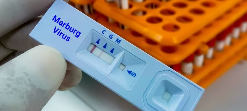 Marburg,Virus,Igg,Positive,Result,By,Using,Rapid,Test,Cassette