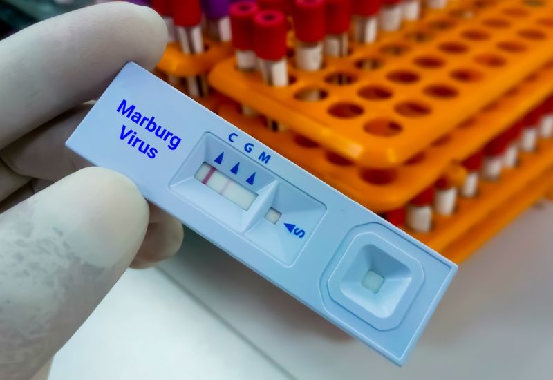 Ιός Marburg: Φόβοι για επιδημία του θανατηφόρου ιού