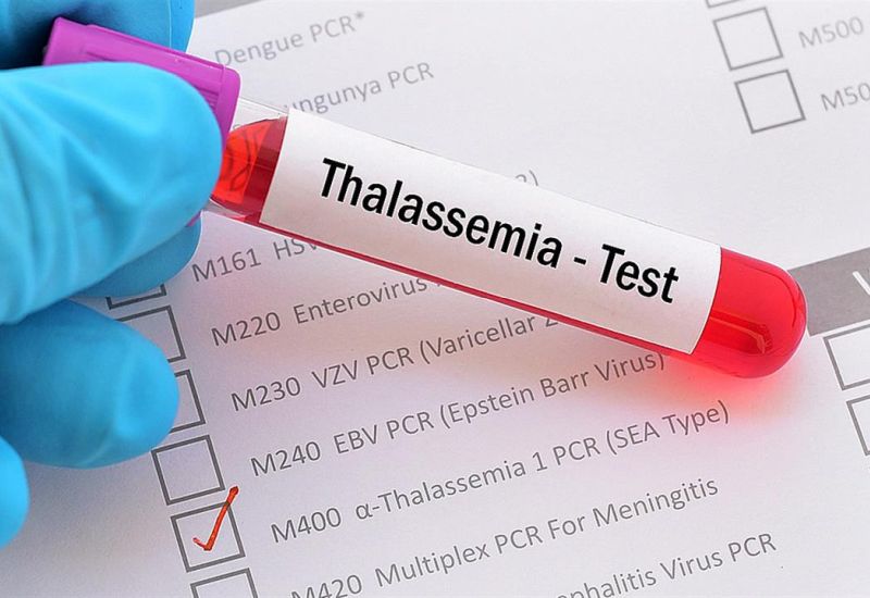 Εγκρίθηκε στις ΗΠΑ η πρώτη γονιδιακή θεραπεία για ασθενείς με θαλασσαιμία