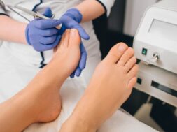 Patient,Receiving,Laser,Treatment,On,Toenail,,Close-up.,Fungal,Infection,On