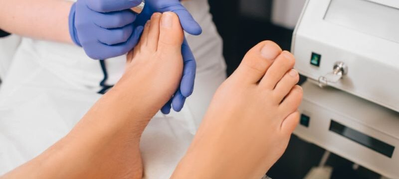 Patient,Receiving,Laser,Treatment,On,Toenail,,Close-up.,Fungal,Infection,On