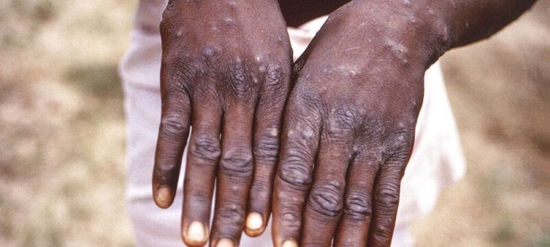 ευλογια-των-πιθηκων