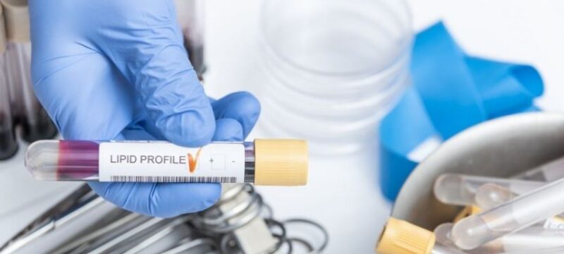 oikogenis-yperxolisterolaimia-pos-antimetopizetai-diatrofika_17185_XL