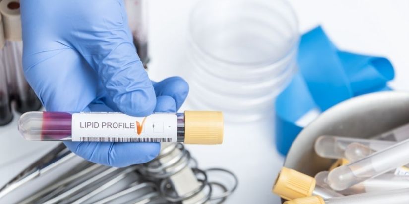 Τι πρέπει να ξέρω για την οικογενή υπερχοληστερολαιμία