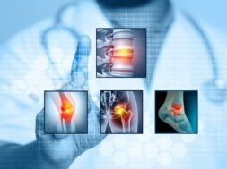 rheumatic-disease-medical-news-july-2022-thumbnail