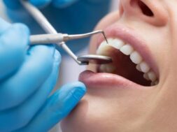tooth-cleaning-925×425