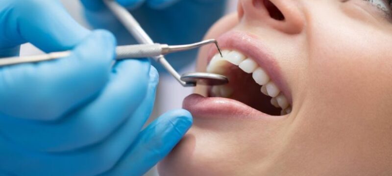 tooth-cleaning-925×425