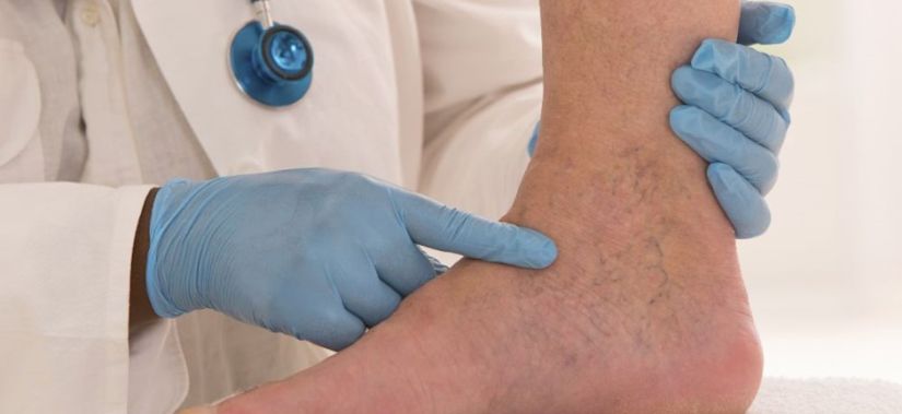 13 Οκτωβρίου 2022: Παγκόσμια ημέρα θρόμβωσης