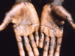 eulogia-ton-pithikon