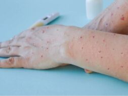 a-70-768×478-768×478