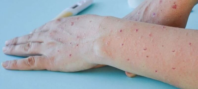 a-70-768×478-768×478