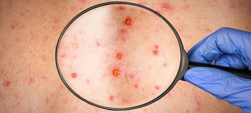 eulogia-ton-pithikon-2-1