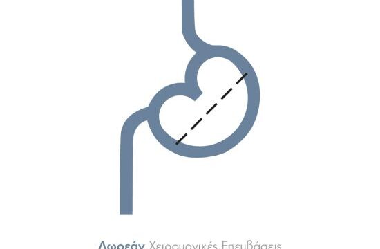 Δωρεάν Χειρουργικές Επεμβάσεις Νοσογόνου Παχυσαρκίας