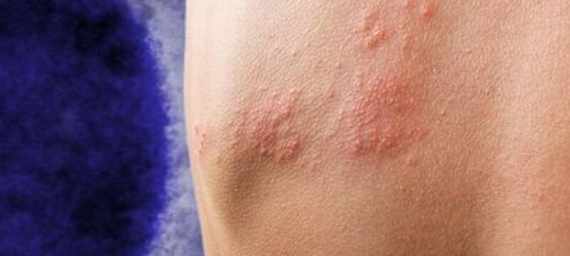 ευλογια πιθήκων 1