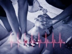 καρδιακη ανακοπη