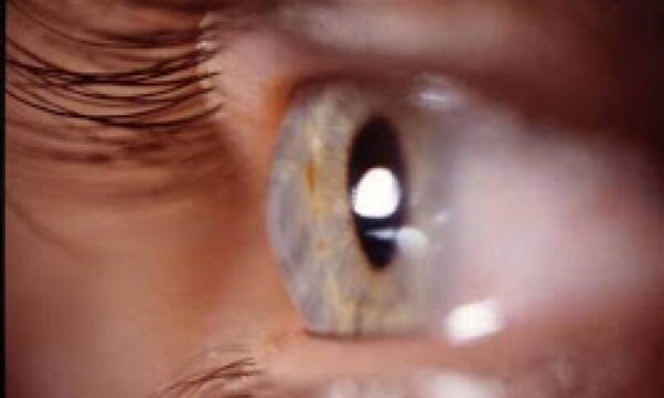 e44a6f32e15cb53ee479b2697e759e2e_L