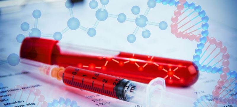 Dna,Testing,Of,The,Blood,In,The,Laboratory,With,Blood
