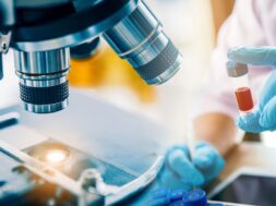 aimatologikos-elegxos_b