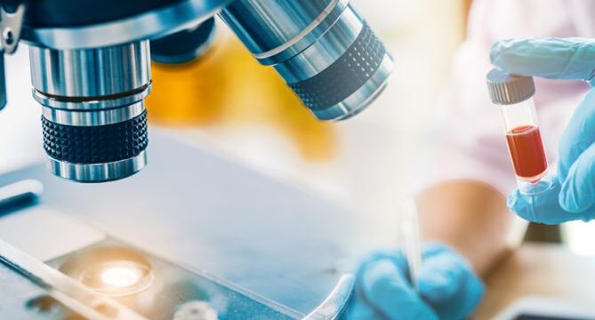 aimatologikos-elegxos_b