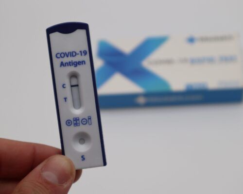 Διενέργεια δωρεάν rapid tests σε 191 σημεία της χώρας