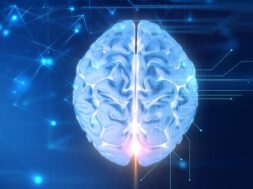 113411-brain221280