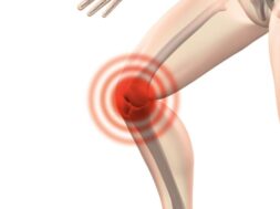 arthrocalman-g38166d49c_1920