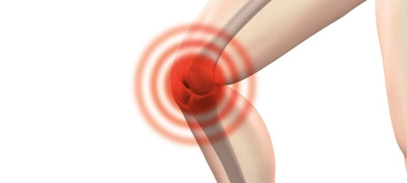 arthrocalman-g38166d49c_1920