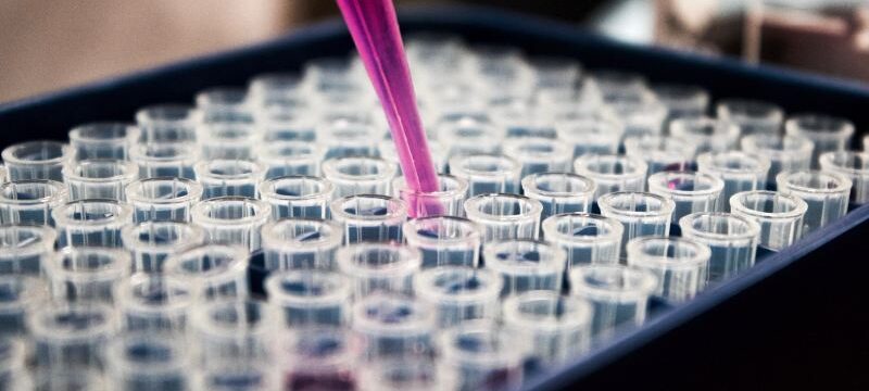 louis-reed-pwcKF7L4-no-unsplash