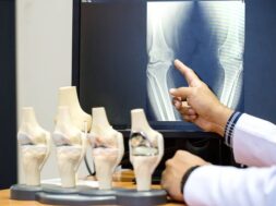 istockphoto-969841754-612×612