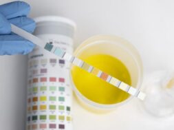 lab-doctor-performing-medical-exam-urine