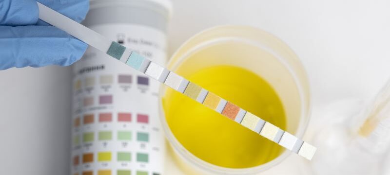 lab-doctor-performing-medical-exam-urine
