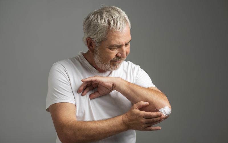 Εγκρίθηκε η θεραπεία με μπιμεκιζουμάμπη για την αντιμετώπιση της ψωριασικής αρθρίτιδας και της αξονικής σπονδυλαρθρίτιδας